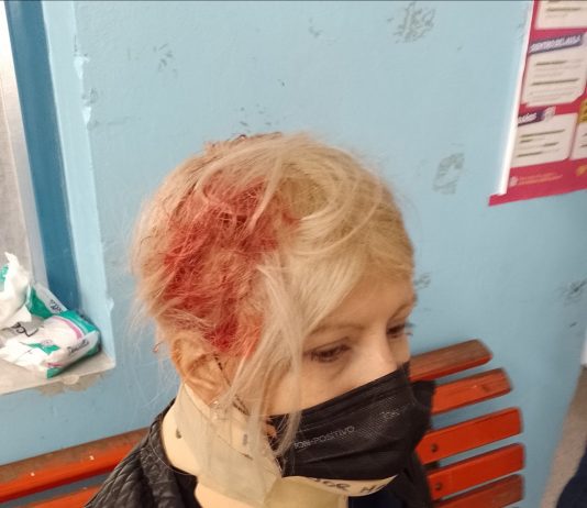 Cayó una ventana en una escuela e hirió a una docente