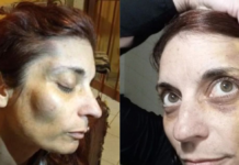 Represión en Jujuy: brutal ataque y tortura a una docente Camila Müller