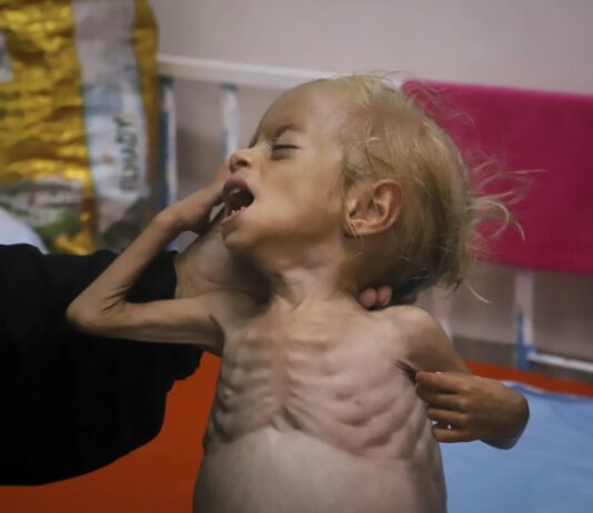 “Piel y huesos”: un relato desde las entrañas del genocidio, escrito por una de las periodistas asesinadas por Israel en un hospital en Gaza Piel y huesos